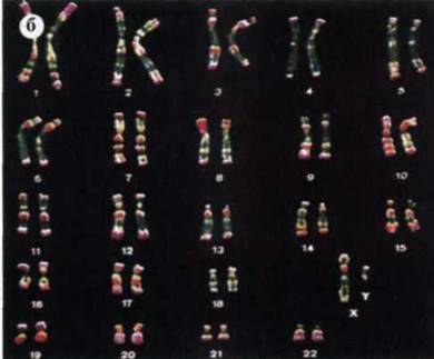 Хромосоми людини