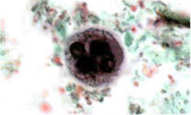 Амеба дизентерійна Entamoeba   Тип Саркоджгутикові Sarcomastigophora. Клас Справжні амеби Lobosea