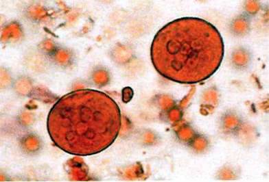 Амеба кишкова (Entamoeba coli)   Тип Саркоджгутикові Sarcomastigophora. Клас Справжні амеби Lobosea