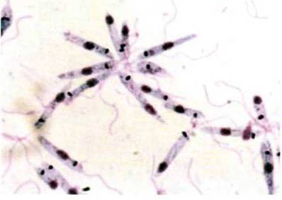 Лейшманії   Тип Саркоджгутикові (Sarcomastigophora). Клас Тваринні джгутикові (Zoomastigophora)