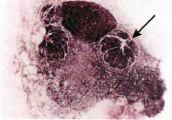 Токсоплазма (Toxoplasma gondii)   Тип Апікомплексні (Apicomplexa). Клас Споровики Sporozoea