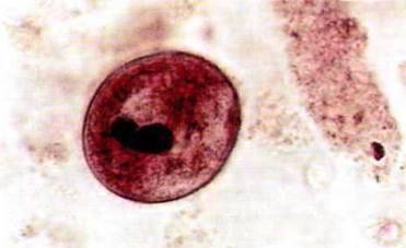 Балантидій (Balantidium coli)   Тип Війконосні Ciliophora. Клас Щілиннороті (Rimostomatea)