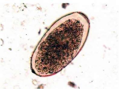 Сисун печінковий, або фасціола (Fasciola hepatica)   Тип Плоскі черви Plathelminthes