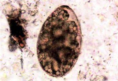 Збудник нанофієтозу (Nanophyetus salmincola)   Тип Плоскі черви Plathelminthes