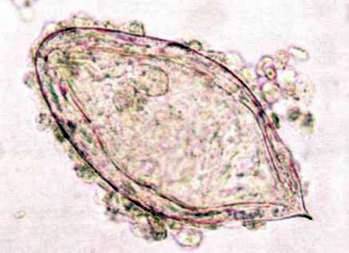 Шистосоми   Тип Плоскі черви Plathelminthes