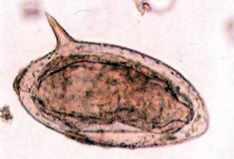 Шистосоми   Тип Плоскі черви Plathelminthes