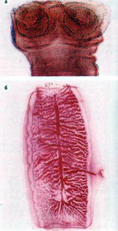Ціпяк неозброєний, або бичачий (Таеniarhynchus saginatus)   Тип Плоскі черви Plathelminthes