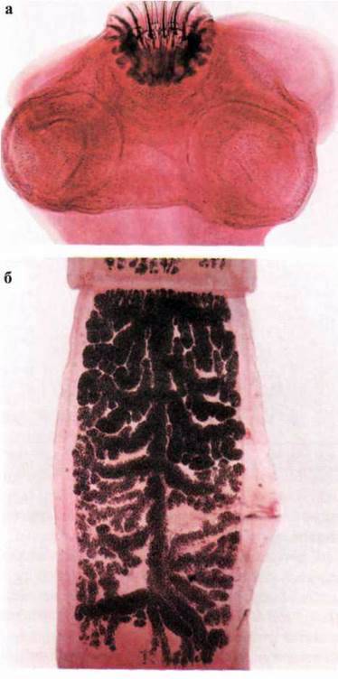 Ціпяк озброєний, або свинячий (Taenia solium)   Тип Плоскі черви Plathelminthes