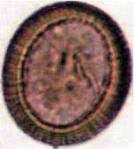 Ціпяк озброєний, або свинячий (Taenia solium)   Тип Плоскі черви Plathelminthes