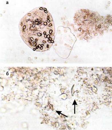 Ехінокок (Echinococcus granulosus)   Тип Плоскі черви Plathelminthes