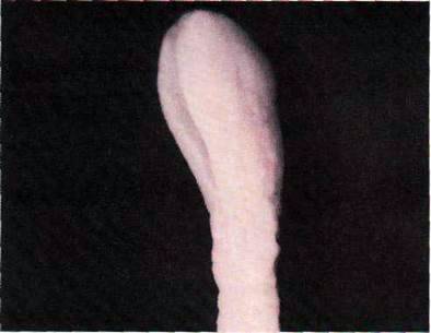 Стьожак широкий (Diphyllobothrium latum)   Тип Плоскі черви Plathelminthes