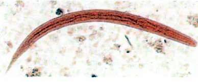 Вугриця кишкова (Strongyloides stercoralis)   Тип Круглі черви (Nemathelminthes)