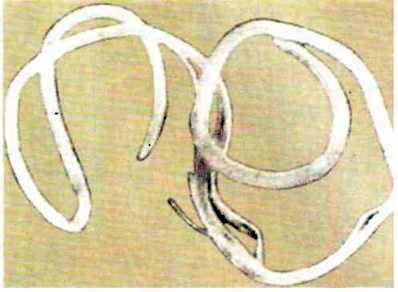 Ришта (Dracunculus medinensis)   Тип Круглі черви (Nemathelminthes)