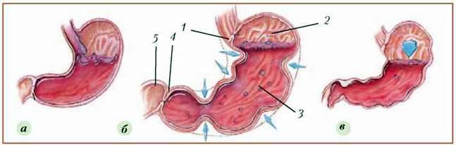 Травлення в шлунку і кишечнику