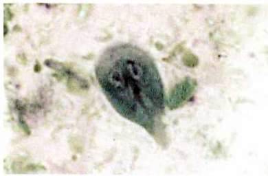 Лямблія (Lamblia intestinalis)   Тип Саркоджгутикові (Sarcomastigophora). Клас Тваринні джгутикові (Zoomastigophora)