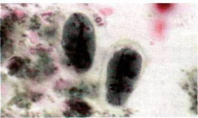 Лямблія (Lamblia intestinalis)   Тип Саркоджгутикові (Sarcomastigophora). Клас Тваринні джгутикові (Zoomastigophora)