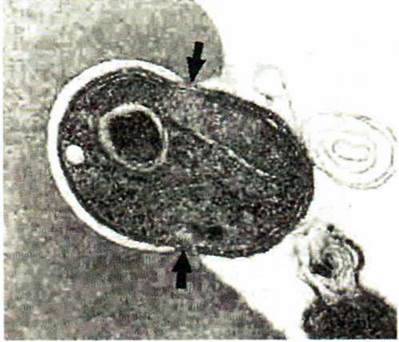 Малярний плазмодій   Тип Апікомплексні (Apicomplexa). Клас Споровики Sporozoea