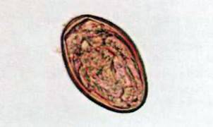 Сисун ланцетоподібний (Dicrocoelium lanceatum)   Тип Плоскі черви Plathelminthes