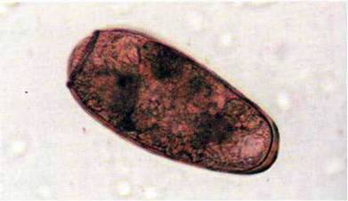 Сисун легеневий (Paragonimus ringeri)   Тип Плоскі черви Plathelminthes