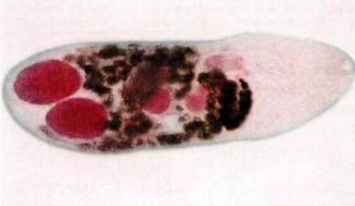 Збудник метагонімозу (Nanophyetes salmincoia)   Тип Плоскі черви Plathelminthes