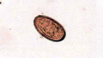 Збудник метагонімозу (Nanophyetes salmincoia)   Тип Плоскі черви Plathelminthes