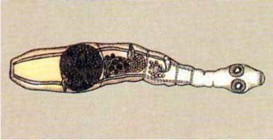 Альвеокок (Alveococcus multilocularis)   Тип Плоскі черви Plathelminthes