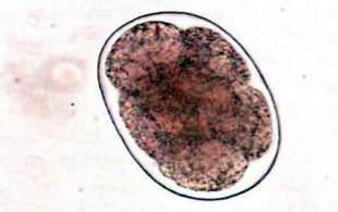Анкілостома (Ancylostoma duodenale)   Тип Круглі черви (Nemathelminthes)