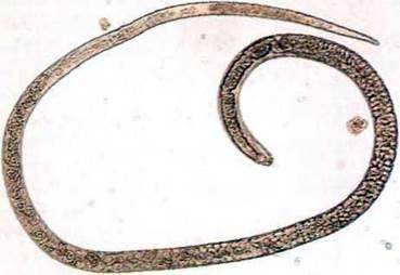 Трихінела (Trichinella)   Тип Круглі черви (Nemathelminthes)